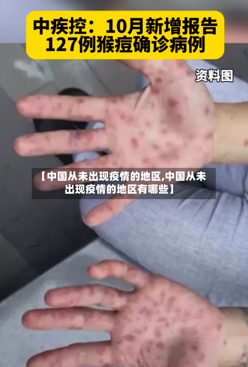 【中国从未出现疫情的地区,中国从未出现疫情的地区有哪些】