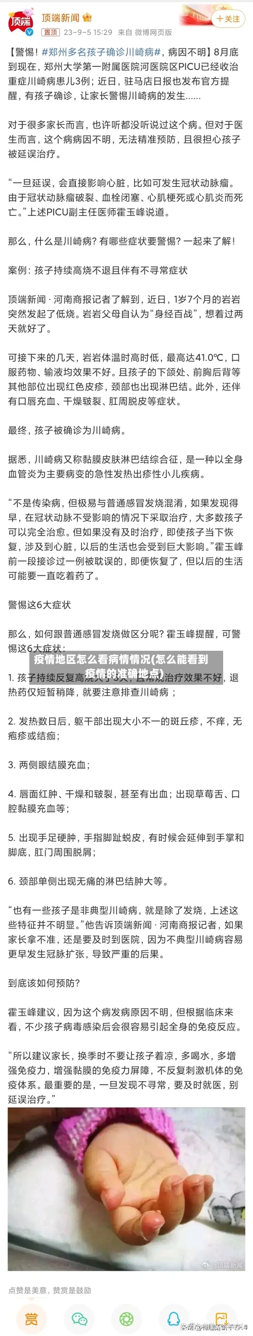 疫情地区怎么看病情情况(怎么能看到疫情的准确地点)